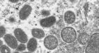 WHO to reconvene emergency meeting on monkeypox as more than 6,000 cases reported in current outbreak