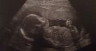 BC man whose wife is on life-support 'overwhelmed' by donations for unborn son